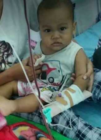 Bocah umur1,8 Tahun Berjuang Melawan Penyakit HEMOFILIA